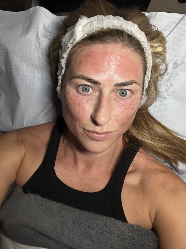 Reviving Radiance at Maylin Clinic London 18 IMG 1749