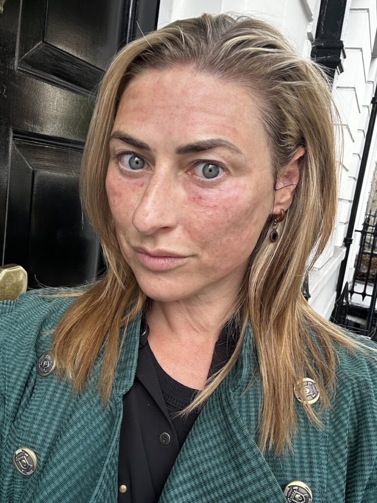 Reviving Radiance at Maylin Clinic London 19 IMG 1756